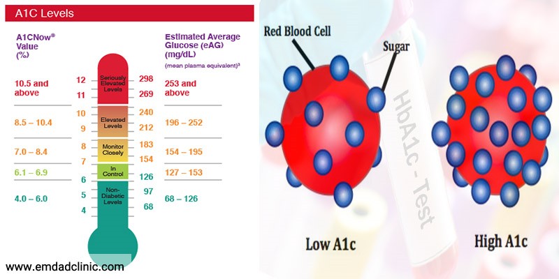 همه چیز درباره آزمایش هموگلوبینA1c در افراد دیابتی